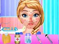 Игра Лечение аллергии Анны онлайн